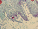 MISSING THUMBNAIL